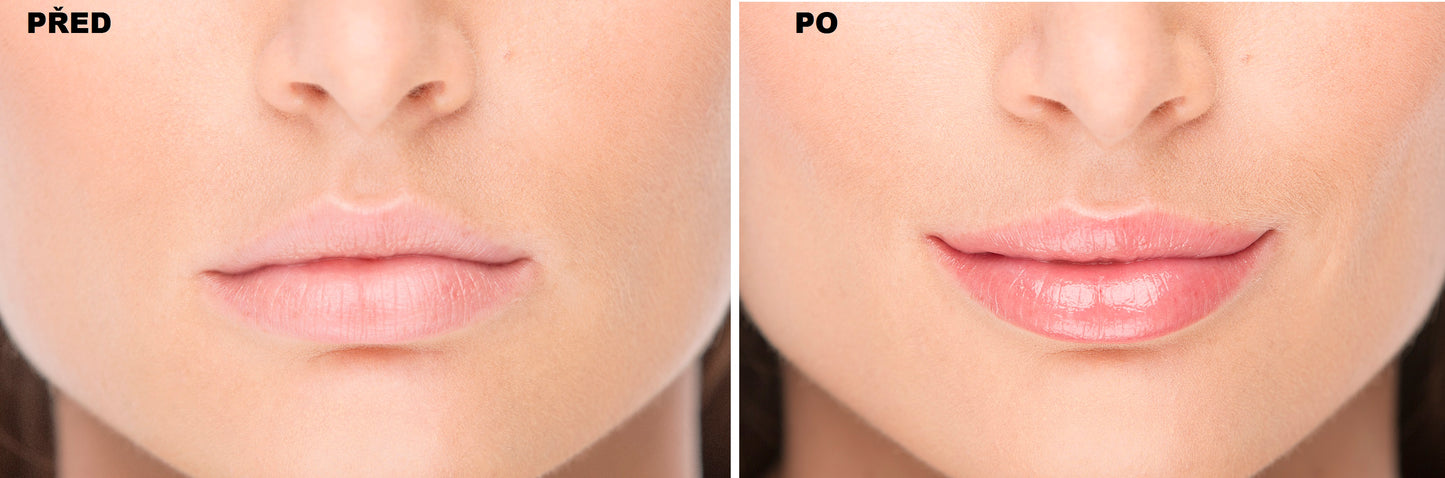 LipPLUS Booster - Classic Trasparente